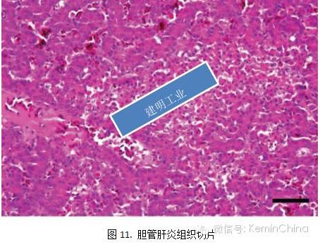 的纤维素性伪膜渗出物形成的伪膜包裹,隐窝变大并且充满坏死的组织,图