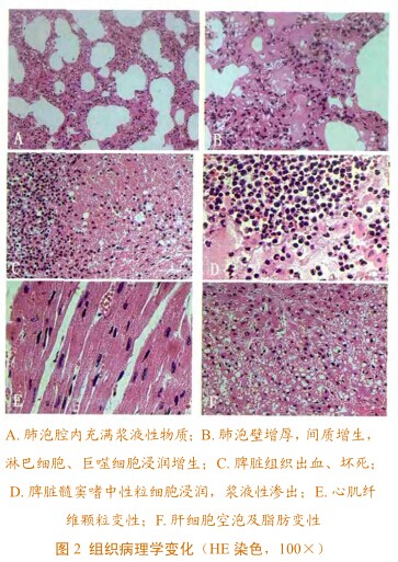 肝细胞水肿颗粒变性图片